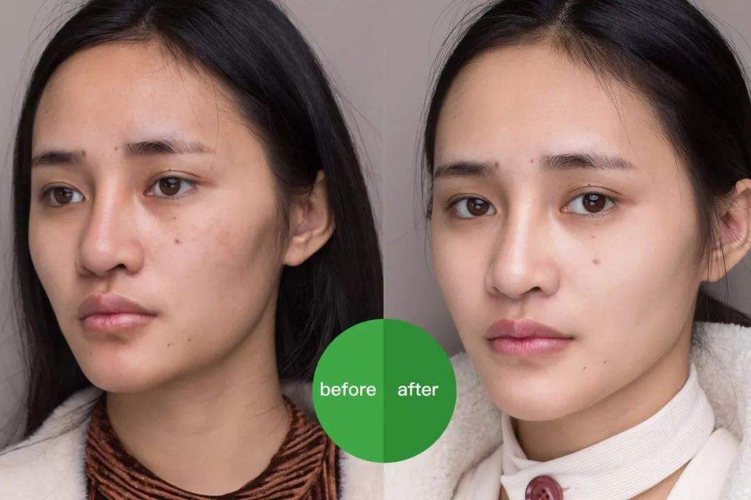 ‘xiongmao体育’
脸上长斑？除了有损颜值 很可能是身体出了问题！(图2)